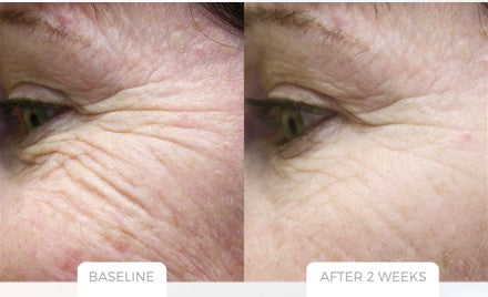nuBARRIER Repair Cream