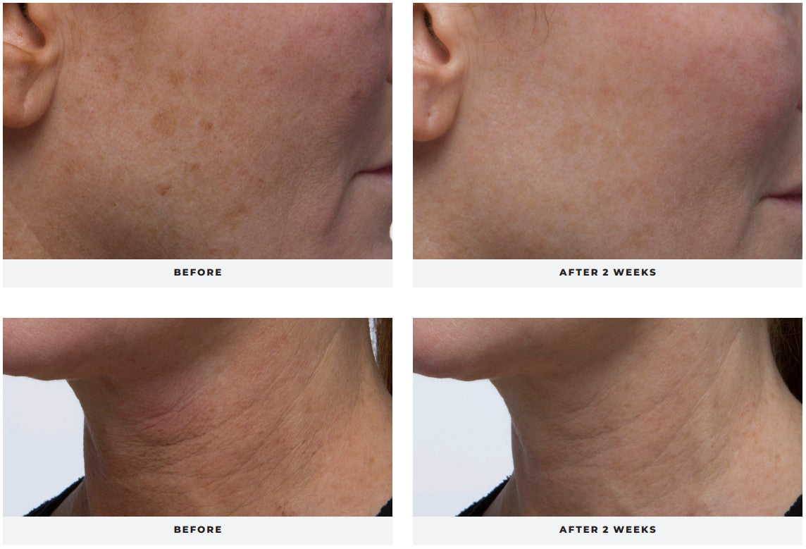 nuFIRM C Serum