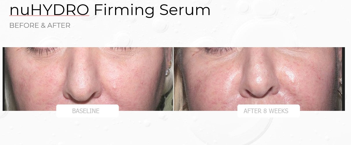 nuHYDRO Firming Serum