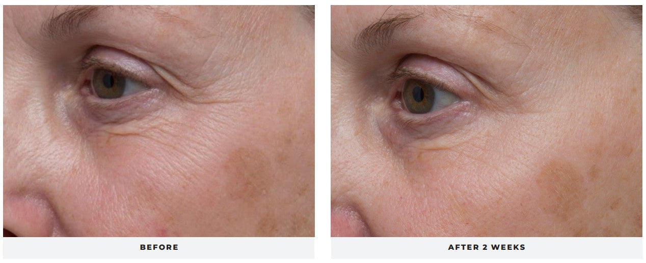 nuSMOOTH Eye Gel