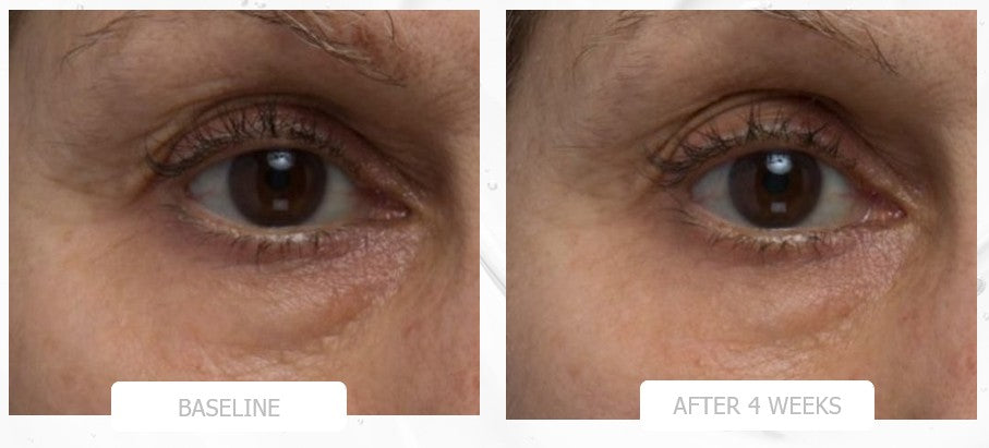 nuSMOOTH Eye Gel